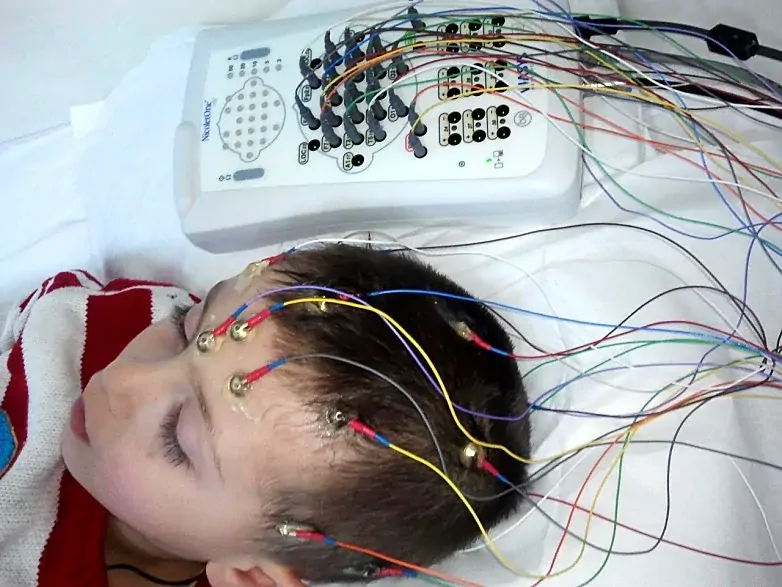 EEG çekiminde saçlı deriye yerleştirilen elektrotlar ve kayıt cihazı