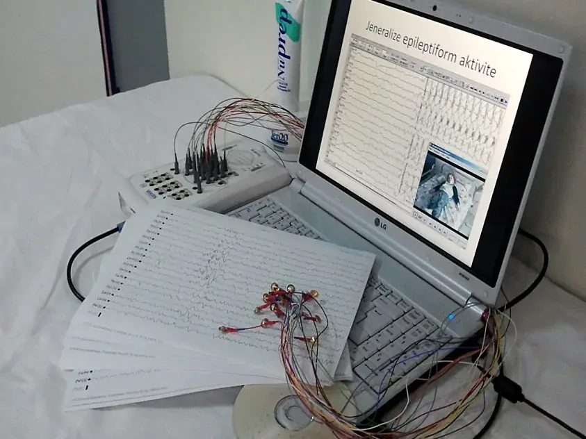 Taşınabilir EEG kayıt cihazı ve dizüstü bilgisayarda EEG kaydı