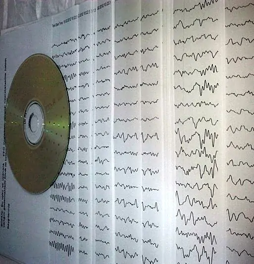 EEG çekimi sonrası teslim edilen CD ve kâğıt döküm