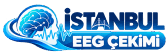 İstanbul EEG Çekimi